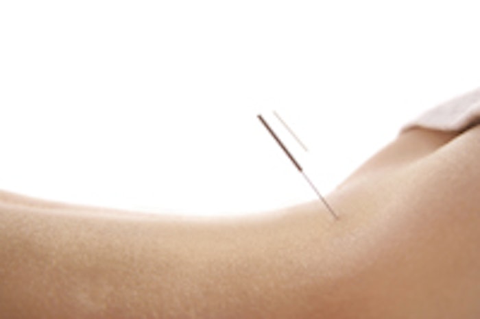 back being acupunctured with two needles on white background