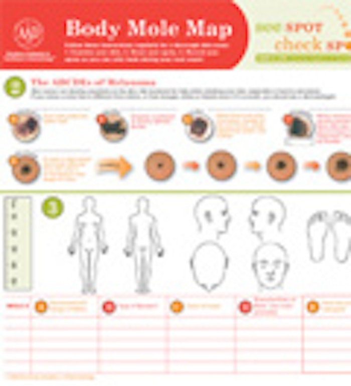 08_402-Melanoma-Monday-Mole1