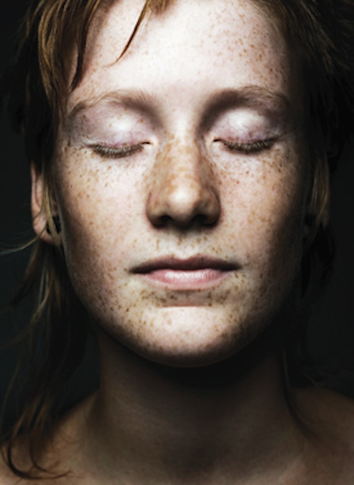 freckle-face_is1