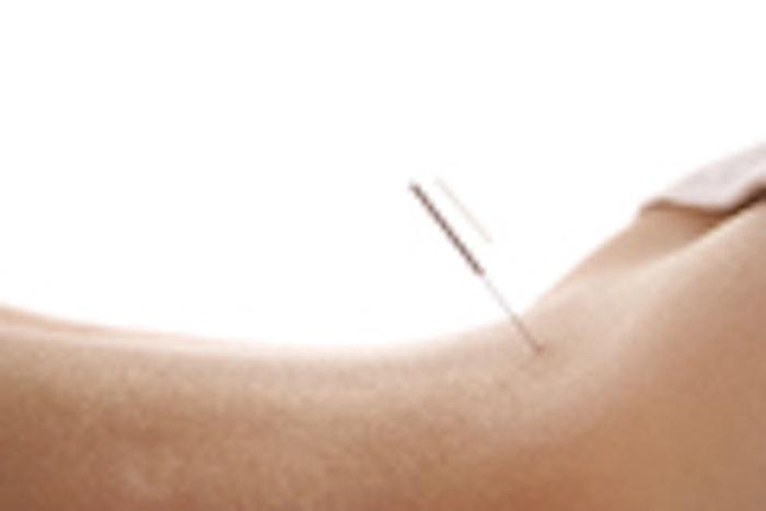 accupuncture_back_is2