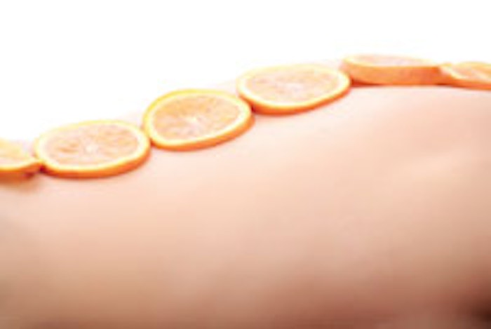 oranges-on-back-copy_m