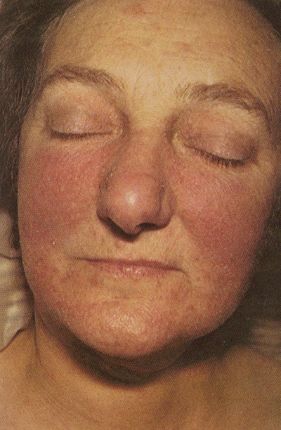 SI0909-Sarfati_image