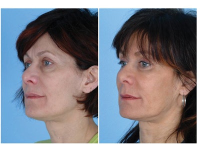 SI0911-Dayan_images3