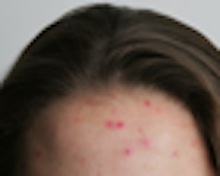 iStock_000006522064Small