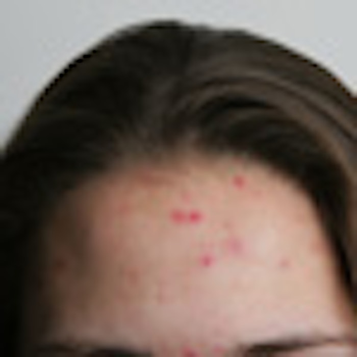 iStock_000006522064Small1