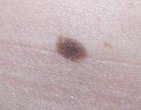 SI1102-Linder_moles.main1