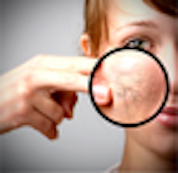 skin_close_up_f1