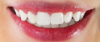 ISTOCKPHOTO.COM