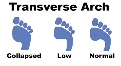 transverse_arch_en_3_f