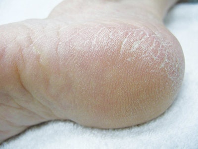 SI1301-Malo_before_f