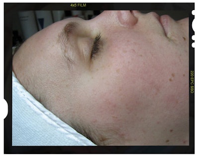 noninflammationafter_frame_f