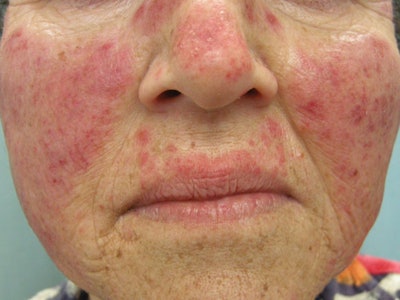 SI1303-Currin_butterfly_f