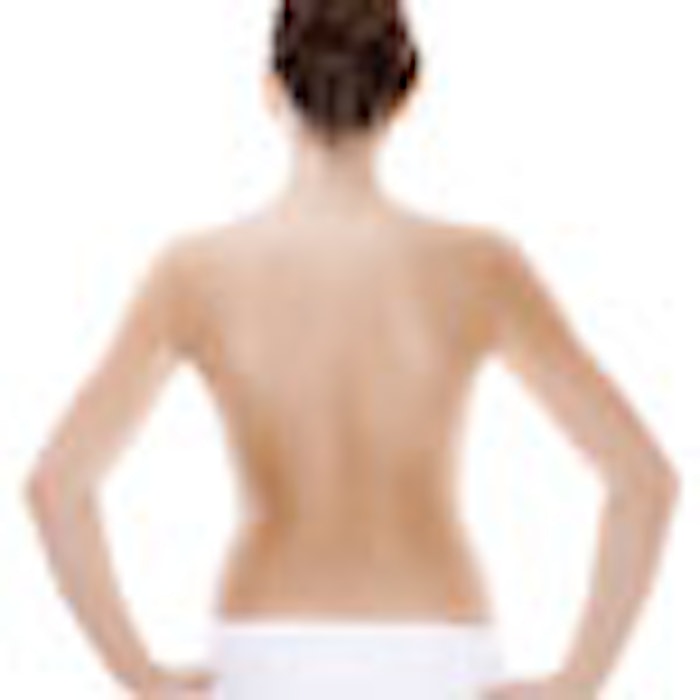 psoriasis1