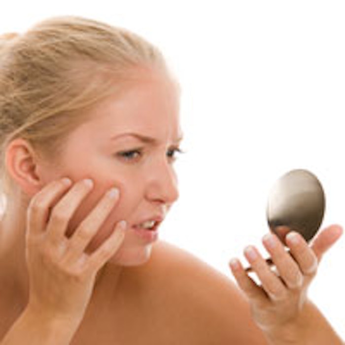 acne_m