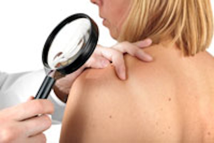 melanoma_main1