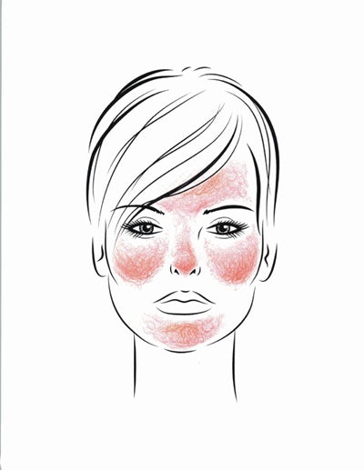facialdistrib