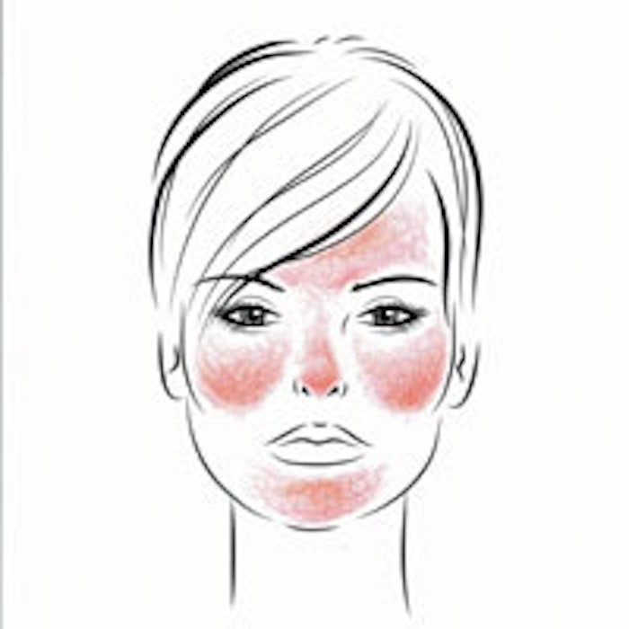 Image courtesy of Cynthia Bailey, MD.