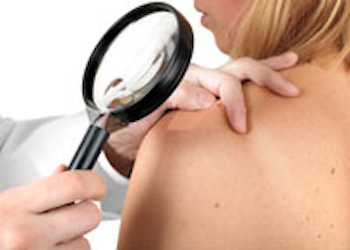 nonmelanoma_m