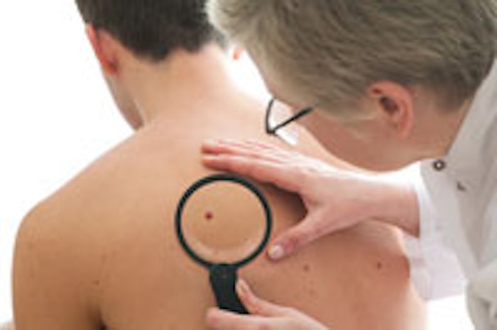 melanoma_m