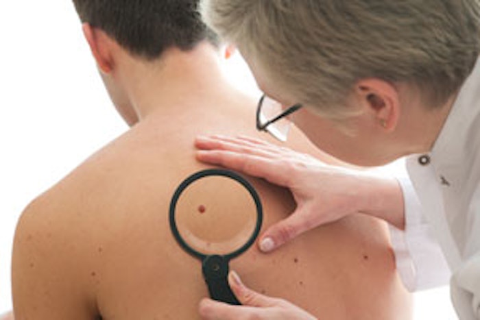melanoma_m4
