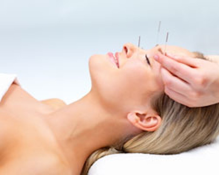 acupuncture_m