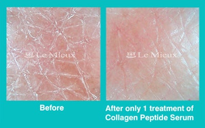Collagen Peptide Serum