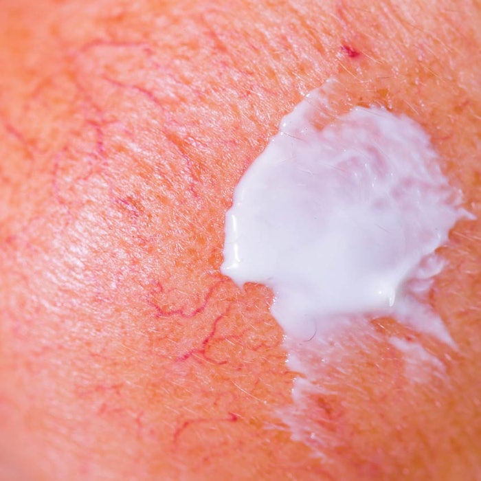 SI1505_Rosacea_Sarfati_850
