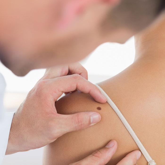 melanomamonday_b