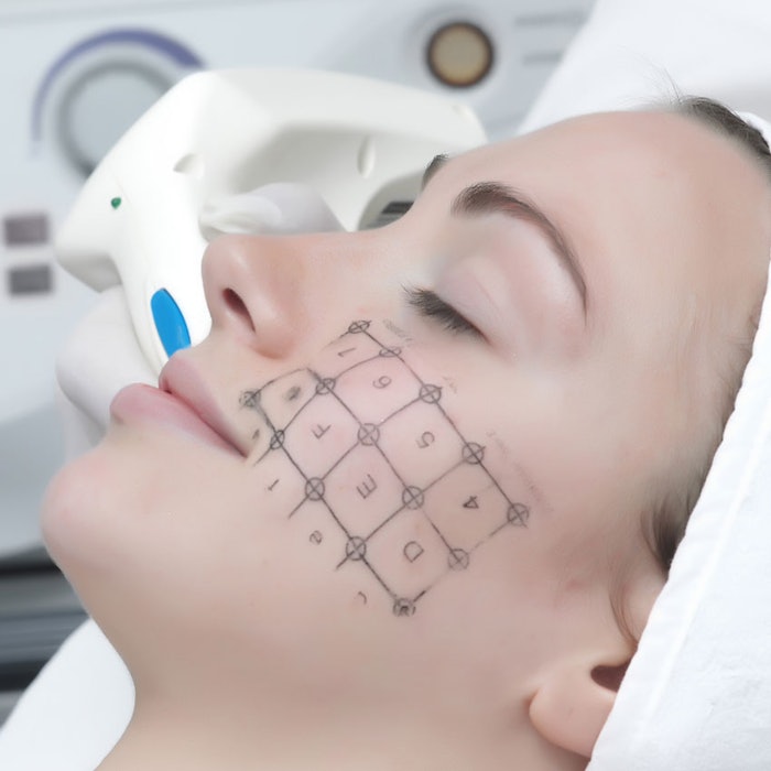 SI_Laser_ready-face_bb