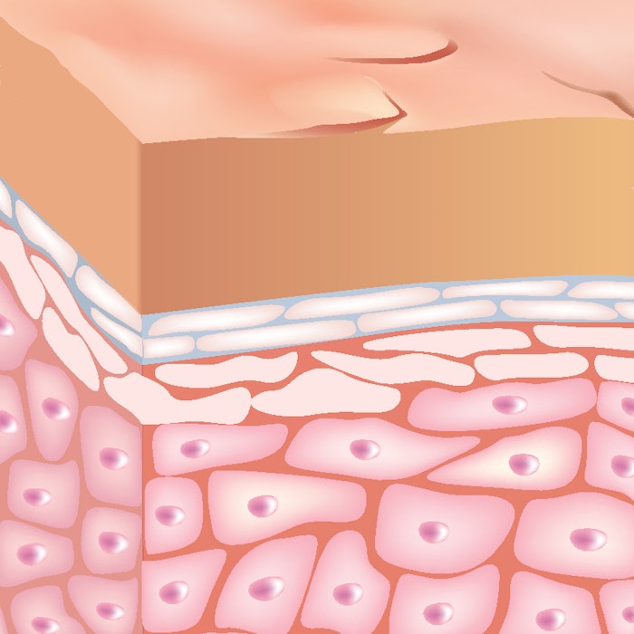 Si1509 News Skin Structure 850