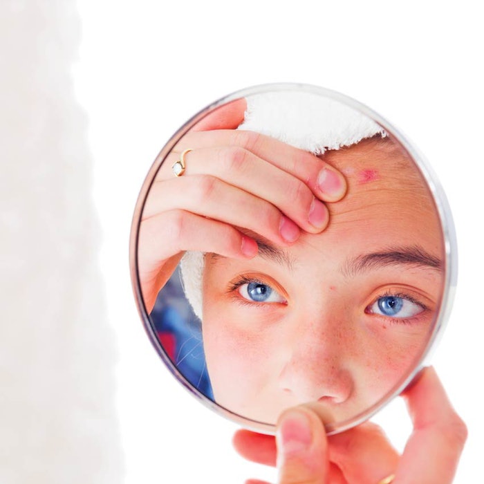 SI1512_SpaSolutions_48855502_acneMirror_850