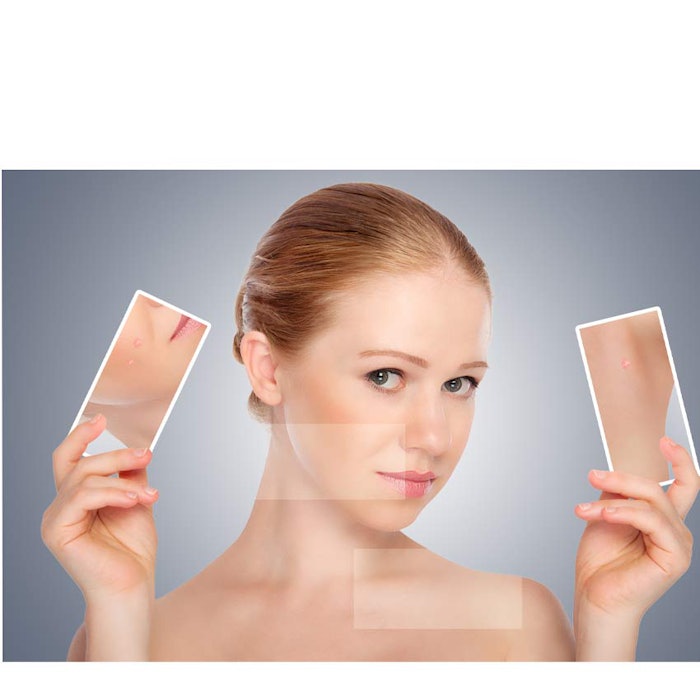 850_womanwithskincarephoto_p