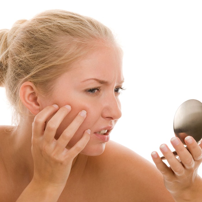 Woman-finding-an-acne-on-her-chin_bb