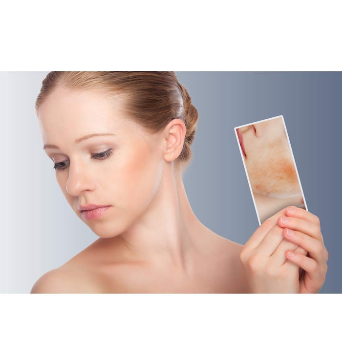 850_womanwithskinredness_p