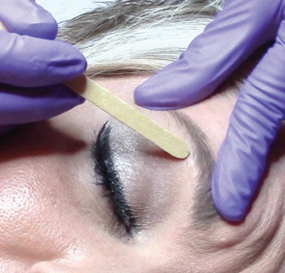 Both technical errors create a lifting of the underlying structure of the skin that over time (a long time) may weaken the muscle, causing it to be more lax, but this is highly unlikely. Keep stretching and pulling of the skin to a minimum during waxing by choosing the right products for the delicate facial area and using the best techniques to prevent damage to the skin.