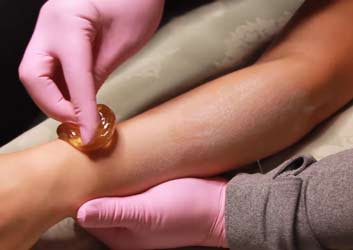 Clients are grateful to the sugaring professional for finally finding a method of hair removal that doesn’t hurt as much, won’t cause them irritation and provides long lasting smooth results. Because sugaring is performed at room temperature, clients can relax and be assured that they will not be burned by product that is too hot.