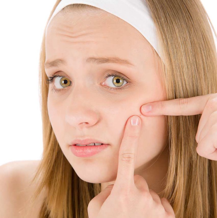 Woman_pimple_bb
