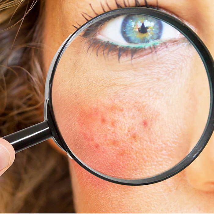 Man shaving with electric razor