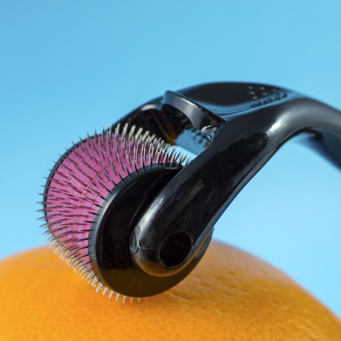 SI_Microneedling_dreamstime