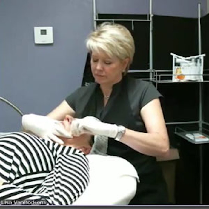 Skinscript_chemicalpeel_tn