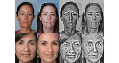 A before and after shot