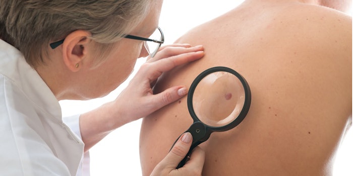 lead_si_melanoma_113016