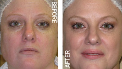 Before and After (1)