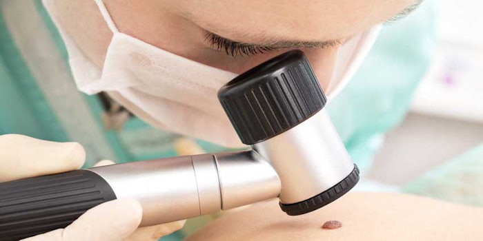melanomadetectionSI_425