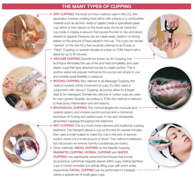 types-of-cupping-therapy