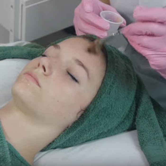 Bion_AcneFacial_tn