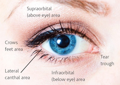 Findings associated with periorbital aging include dark under-eye circles, “bagging” or loss of elasticity, shadowing in the tear trough, crows’ feet or wrinkling lateral to the eye, and loss of opacity (increased translucency) of the under-eye skin.3 Thus, the periorbital area mandates earlier and more aggressive protection to avoid early aging.