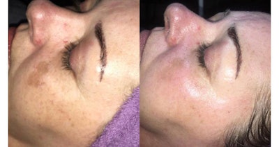 Dermamed Si1705 Intext