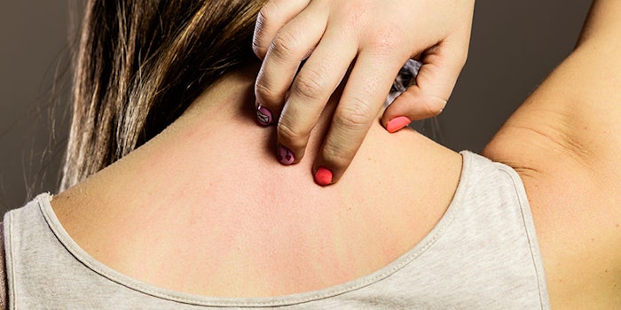 ADermatitisTreatment_425