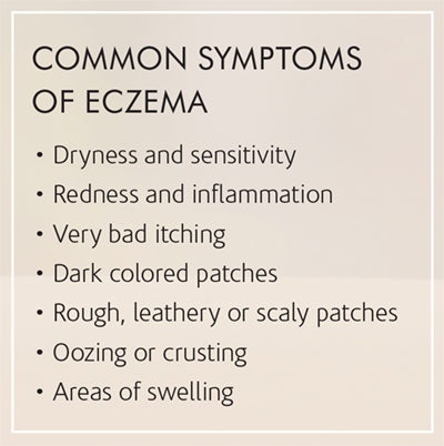 Si1707 Eczema Sidebar 400